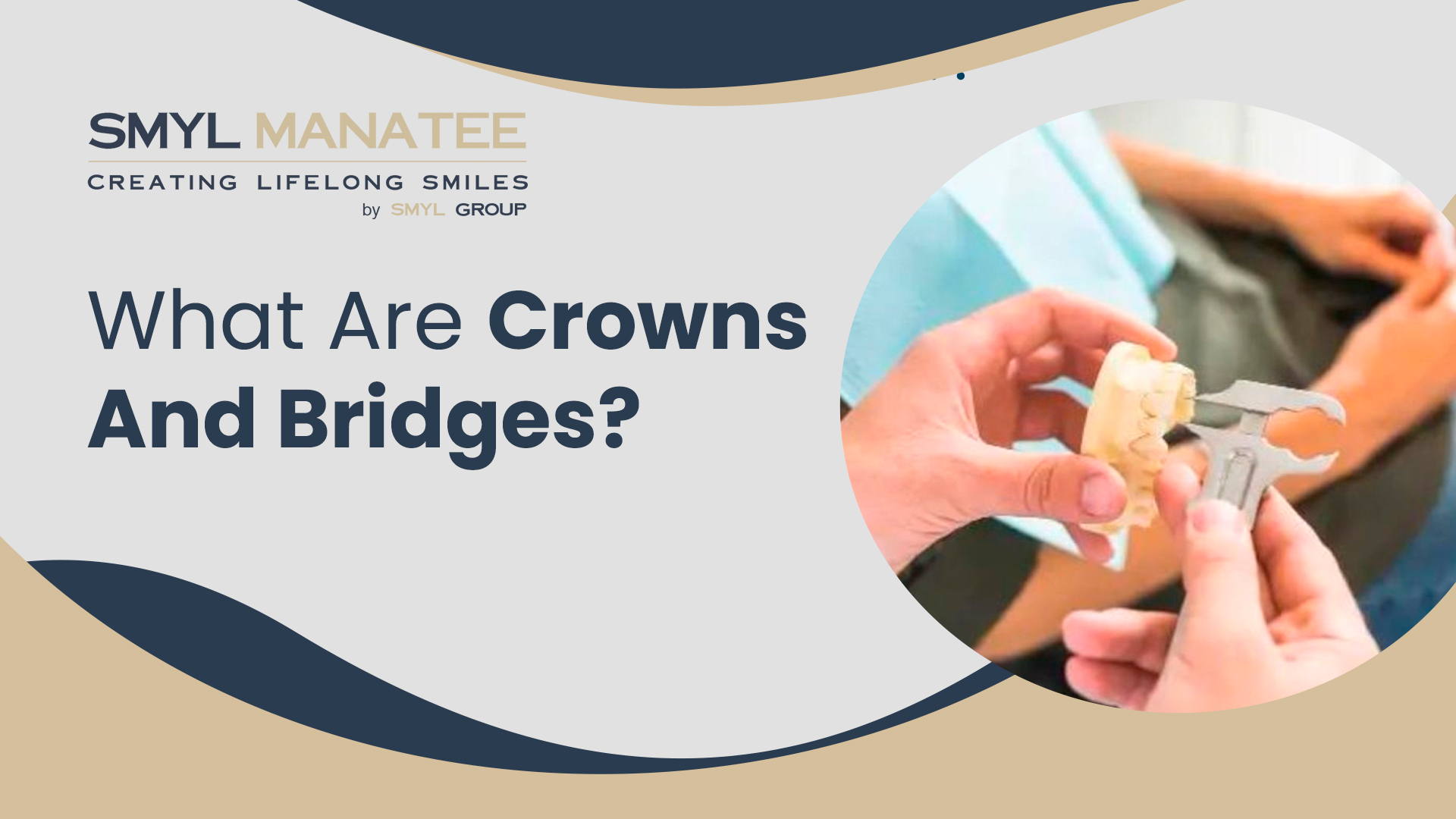 What are Crowns and Bridges?