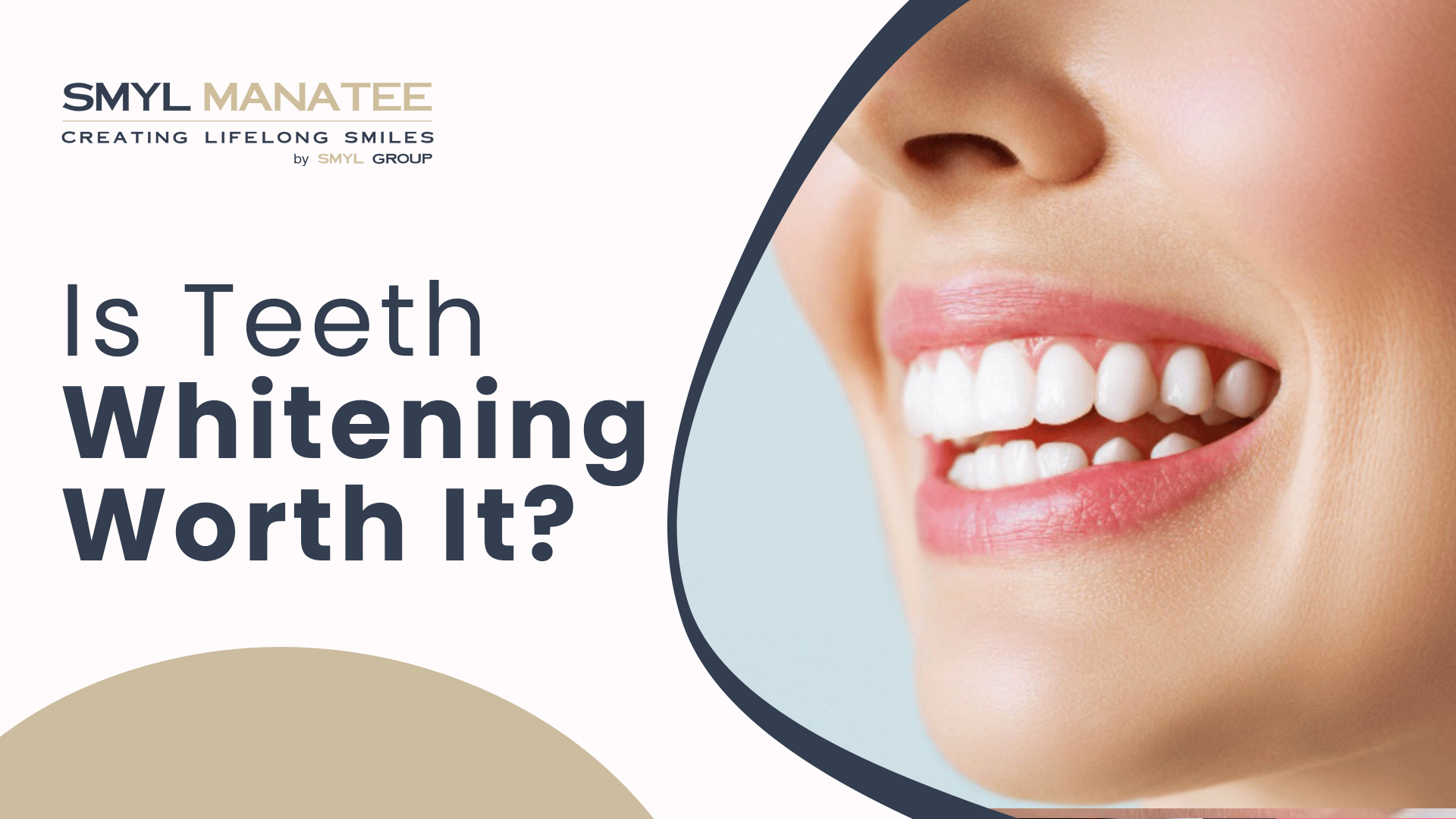 Is Teeth Whitening Worth it?