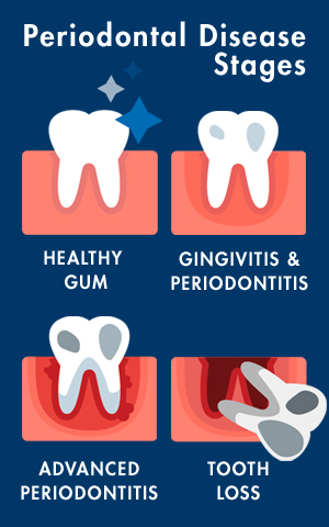 Periodontitis